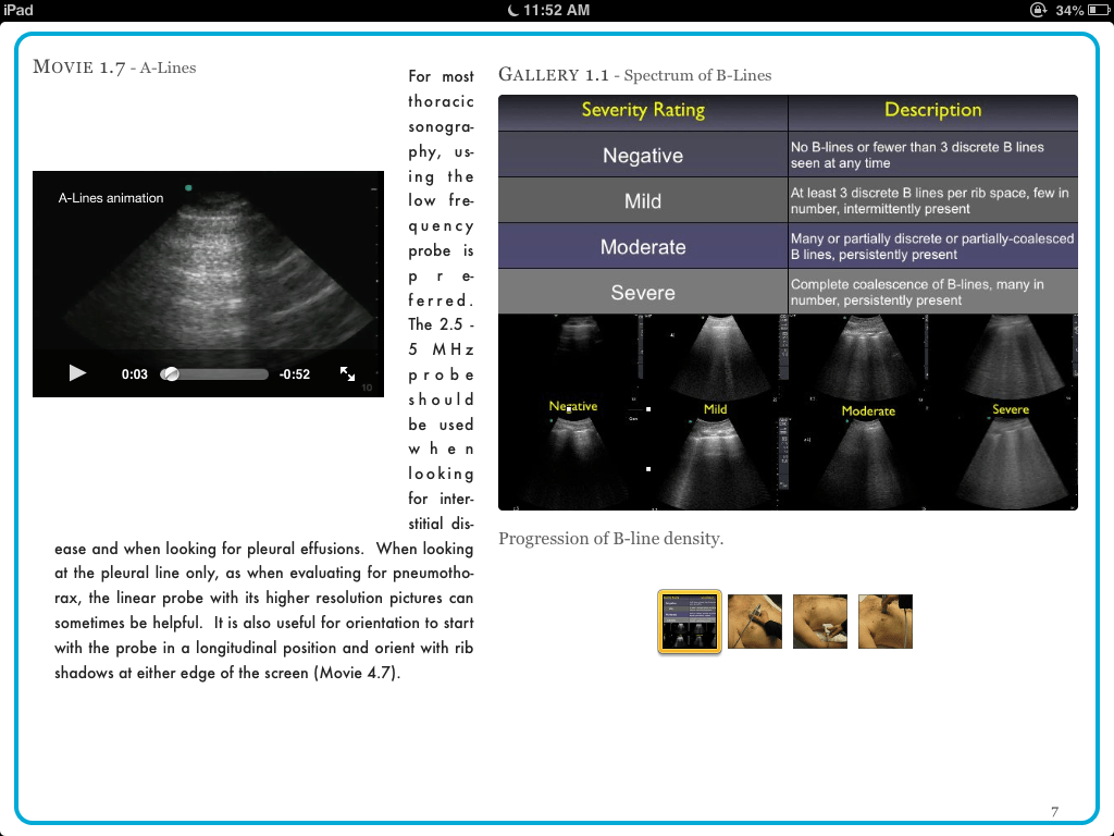 Introduction to Bedside Ultrasound is the first complete interactive