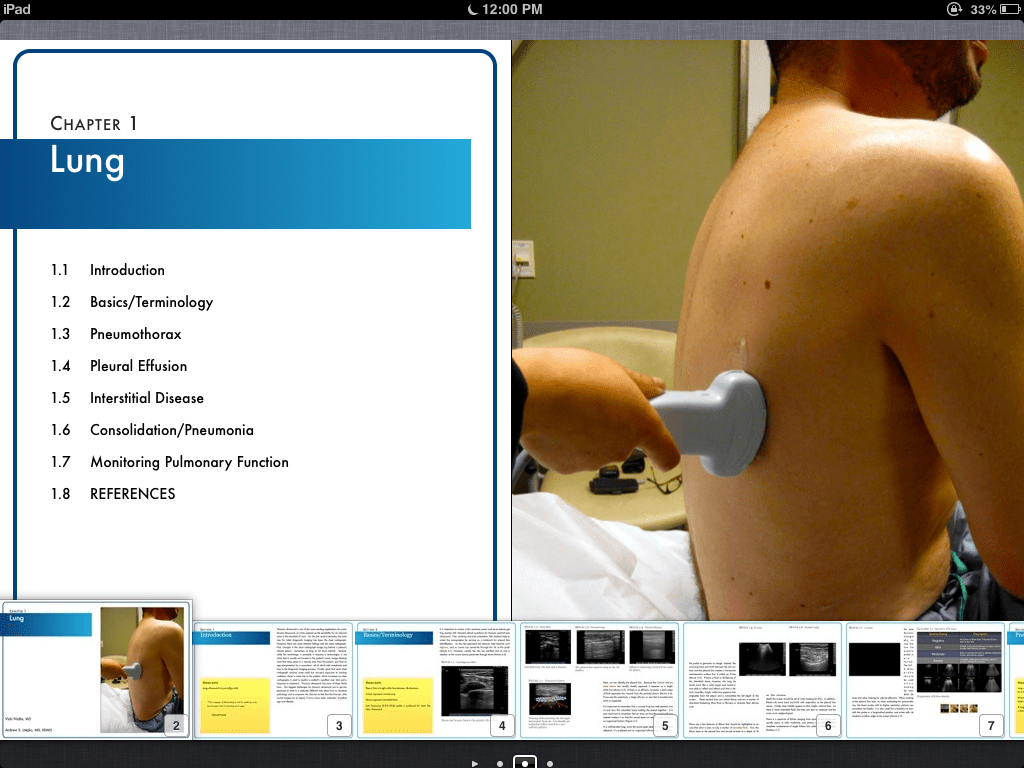 Introduction to Bedside Ultrasound is the first complete interactive