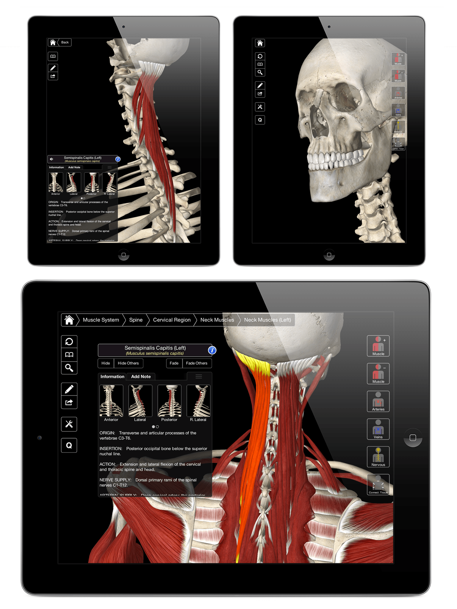 3D4Medical prepare to launch unique 3D essential anatomy app [exclusive demo]