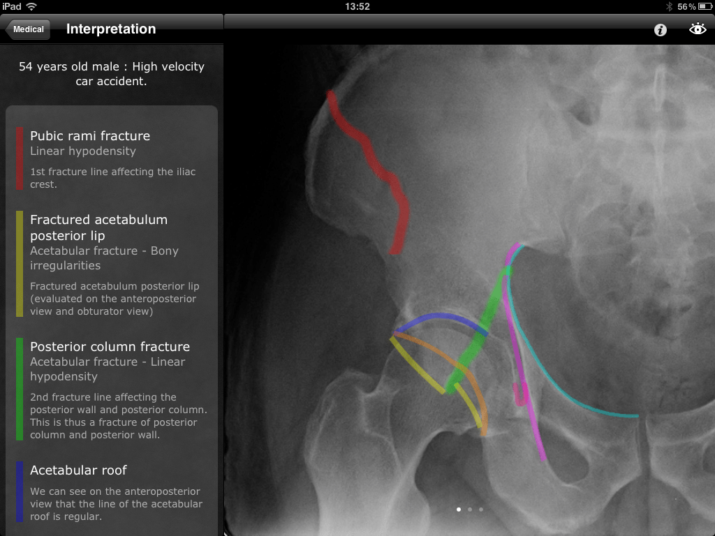 Top 15 medical apps for orthopedic surgeons