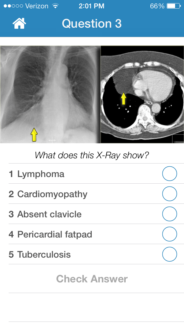 Chest Xray Training iphone and ipad medical app review