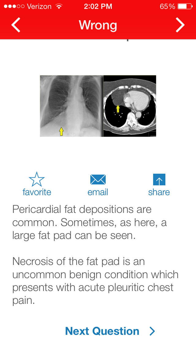 Chest Xray Training iphone and ipad medical app review
