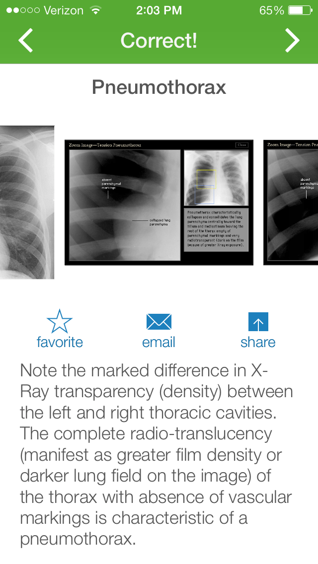 Chest Xray Training iphone and ipad medical app review