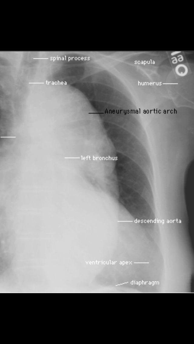 Chest Xray Training iphone and ipad medical app review