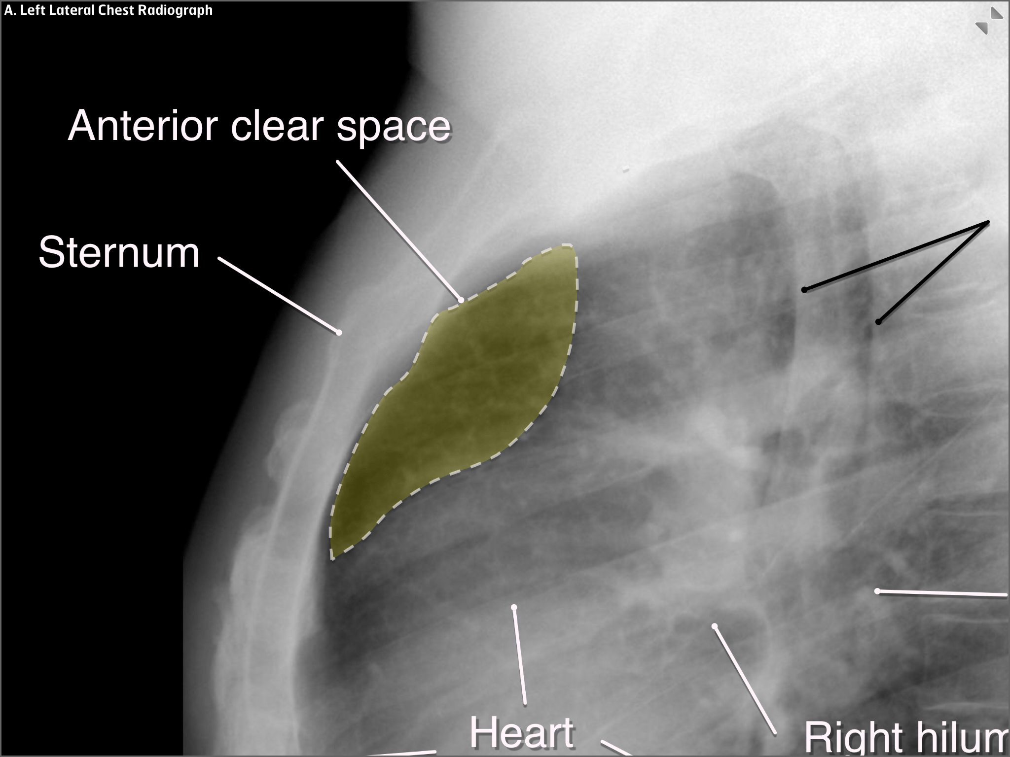 Diagnostic Radiology Chest Primer iphone and ipad medical app review