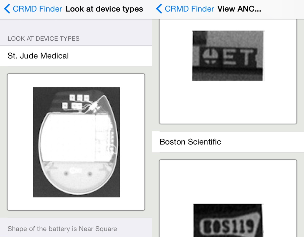 CRMD Finder identifies cardiac device based on chest xray iMedicalApps
