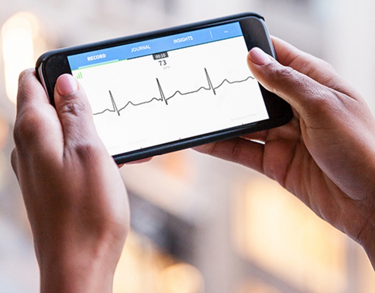 AliveCor Heart Monitor used to detect postoperative atrial fibrillation