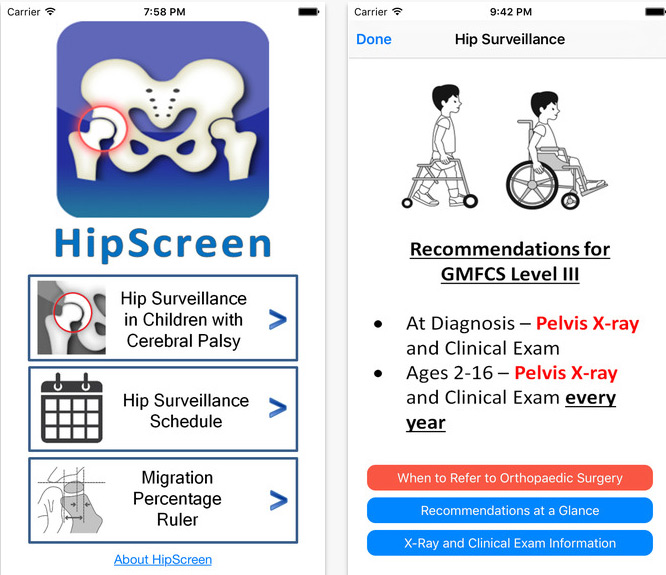 Review of Hip Screen app, a pediatric surveillance tool for Cerebral