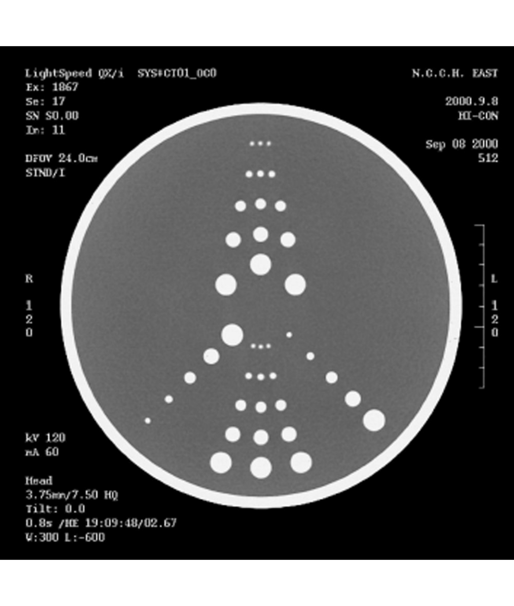 Ultrasound Guided Tube Feeding Phantom (US20) Imaging Solutions
