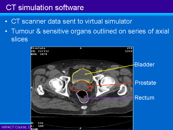 CT simulation software