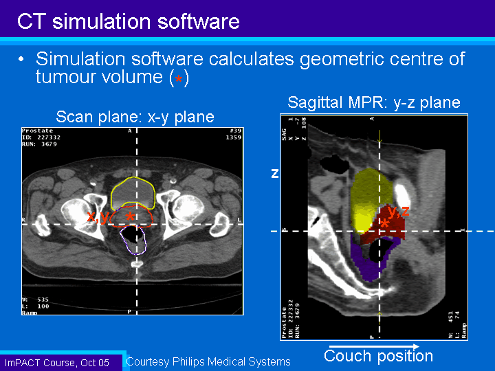CT simulation software (3)