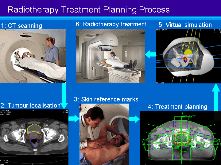 A. Patient Preparation Radiation Therapy Group Project