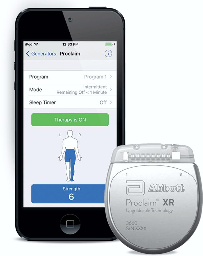 SCS Companies Developing “Low Dose” RechargeFree Spinal Cord