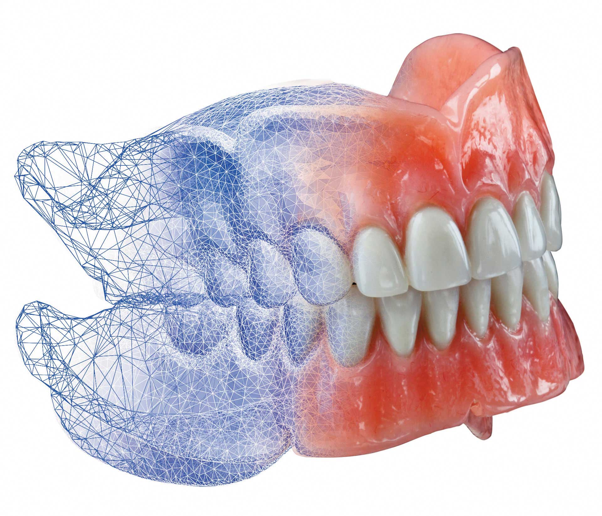 AvaDent® Dentures Shenandoah Valley Implant Institute