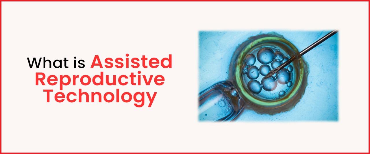What is Assisted Reproductive Technology Imprimis IVF