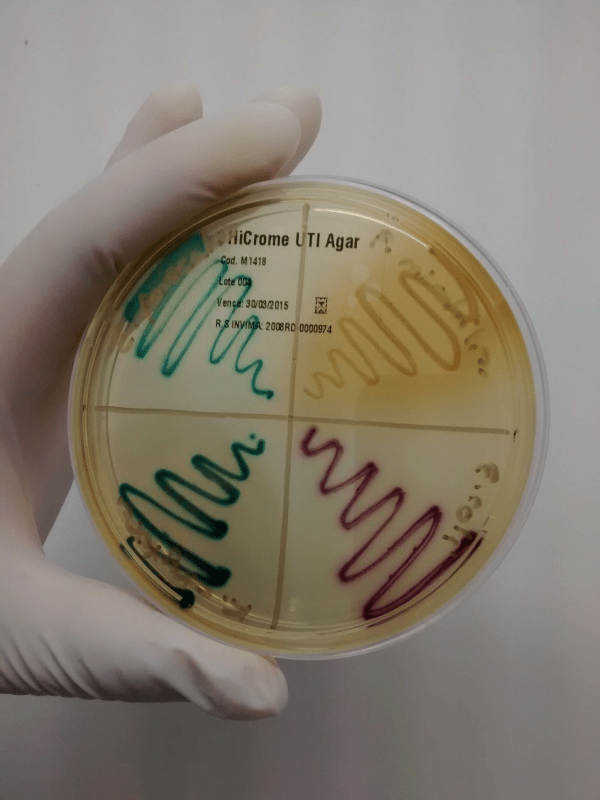 CROMOGENICO UTI AGAR INDUSTRIA NACIONAL DE MICROBIOLOGIA SAS