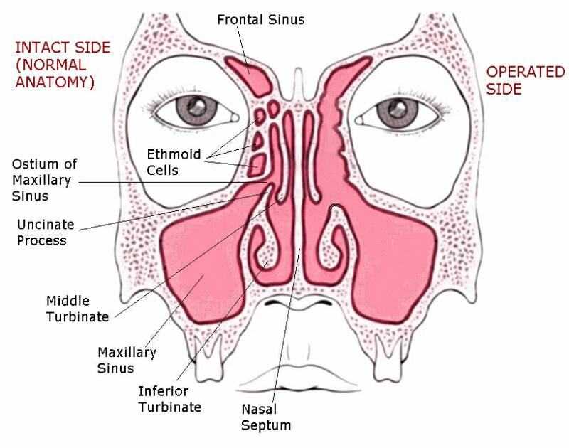 Nasal Obstruction Treatment Indigo ENT Specialists