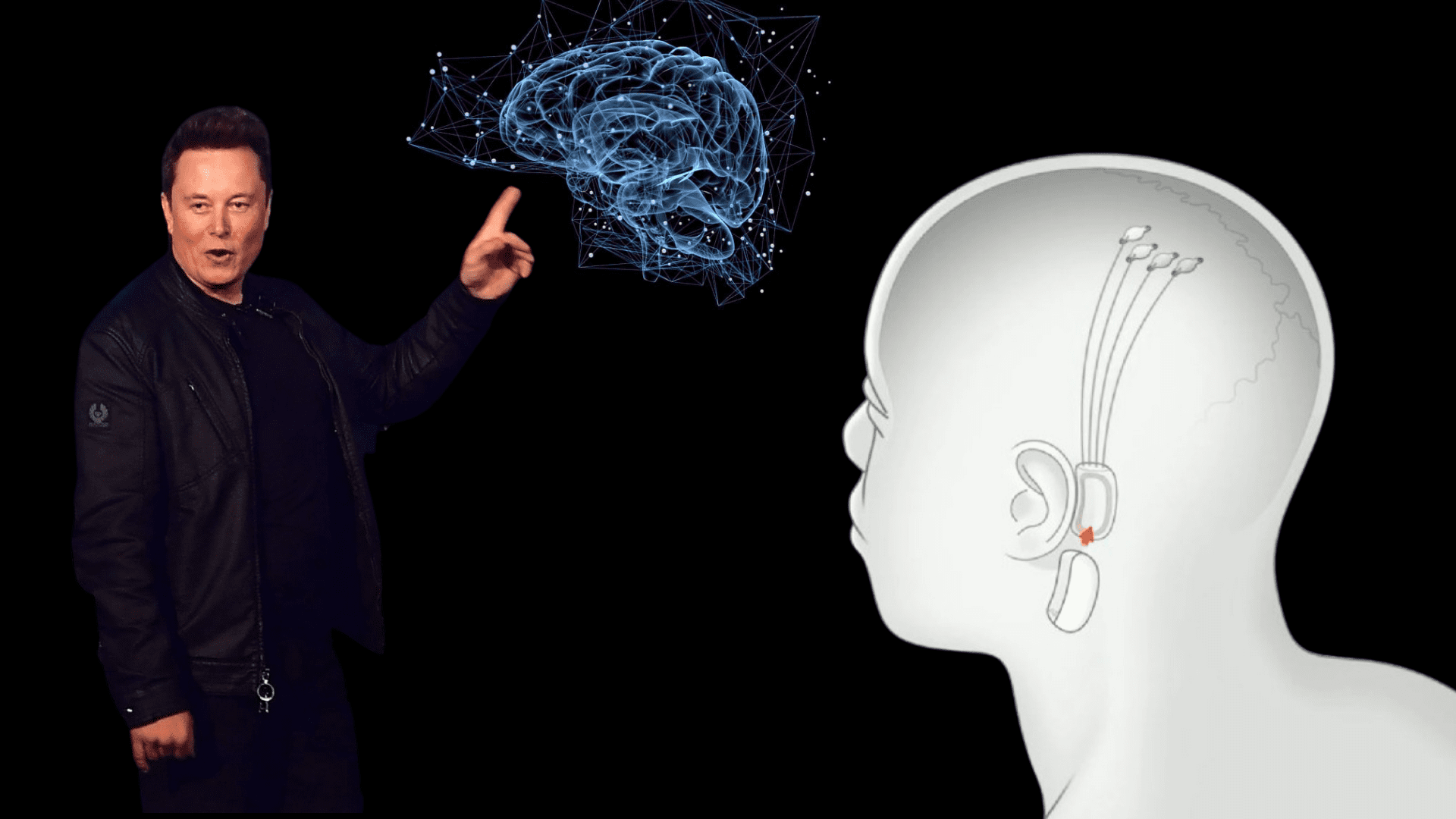 Neuralink Are We Successful In Hacking The Human Brain?
