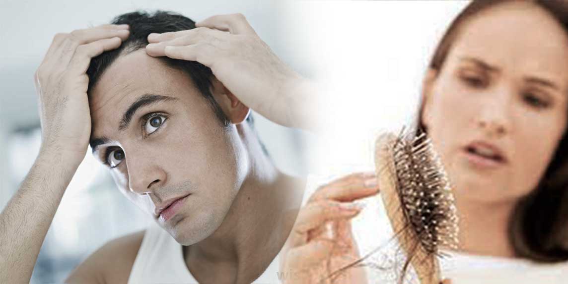 It's National Hair Loss Awareness Month. Innovate Salon Academy