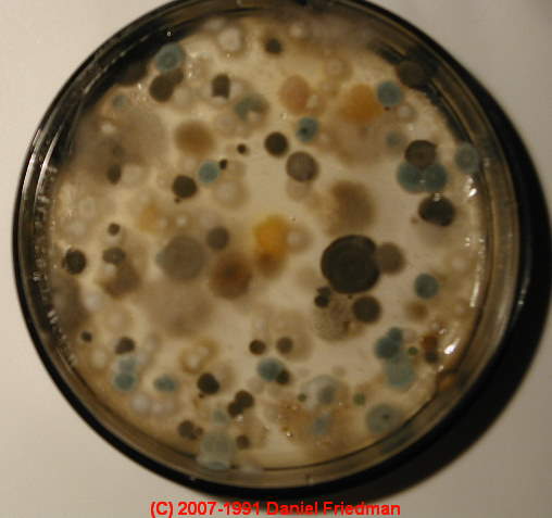 Mold Related Illness Index of Symptoms of Common and