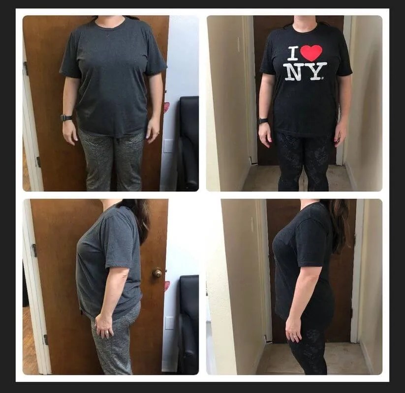 Weight Loss Results Before & After Inspire Weight Loss Reviews