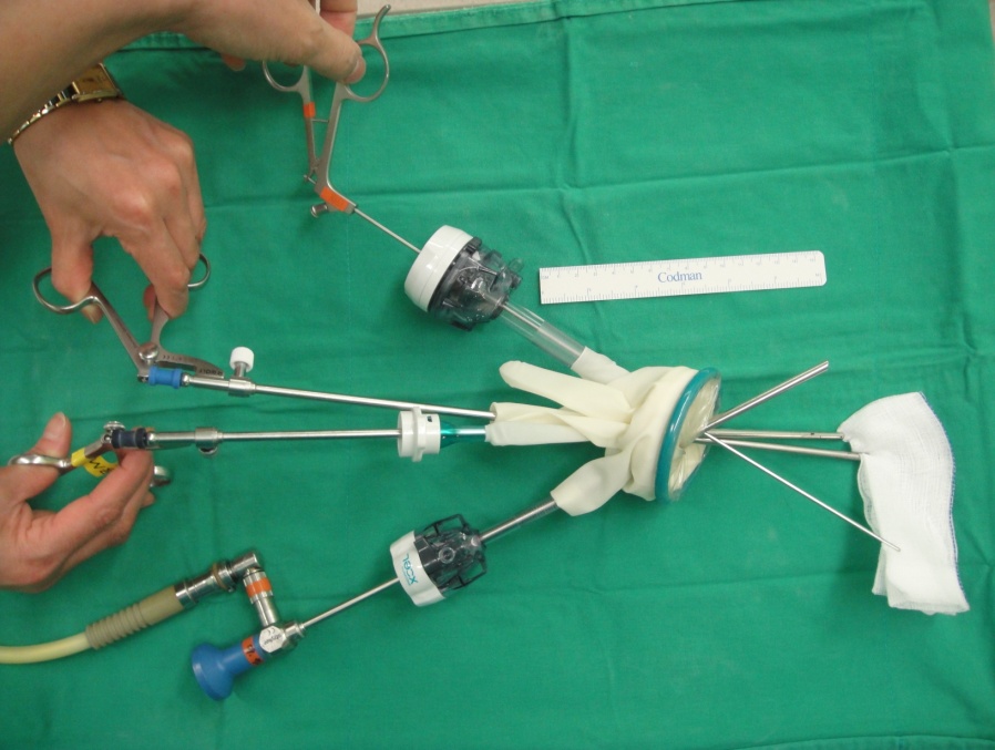 SinglePort Access Laparoscopic Surgery in Gynecology Technical Tips