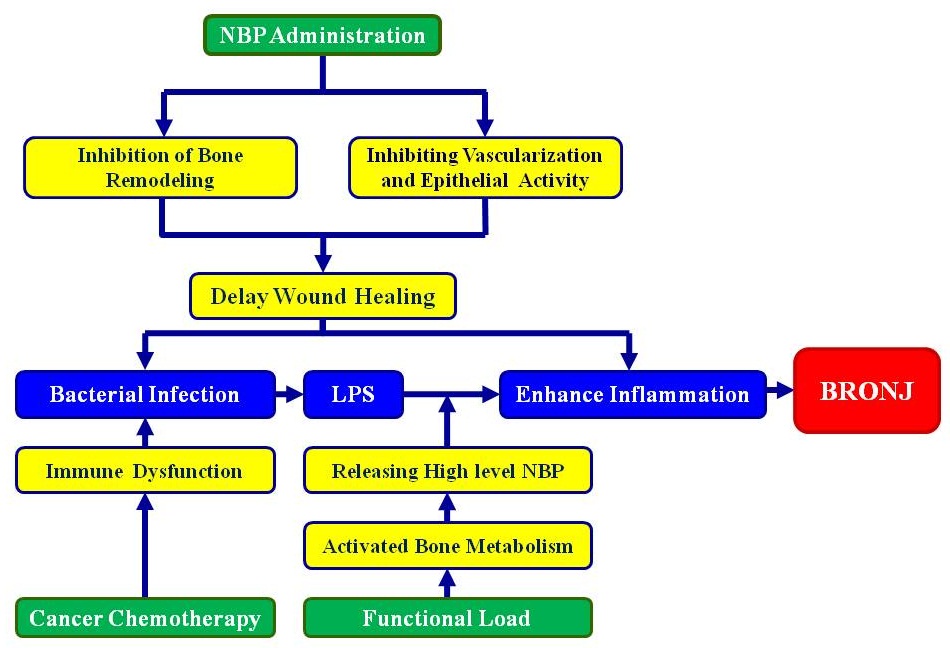 BisphosphonateRelated Osteonecrosis of the Jaw Around Dental Implants
