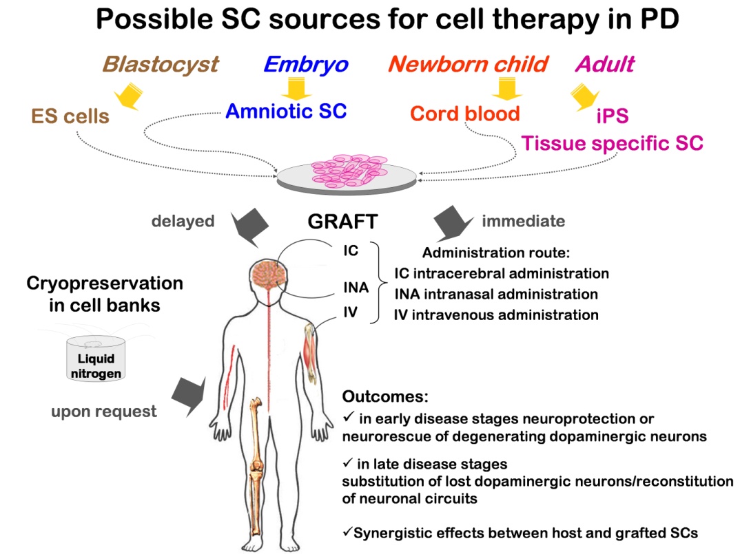 19802011 Parkinson's Disease and Advance in Stem Cell Research