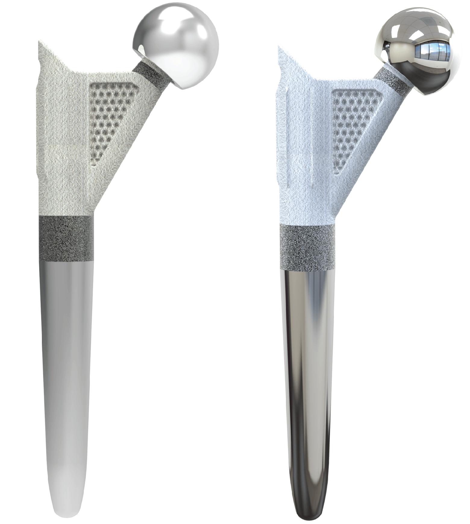 “NeckSparing” Total Hip Arthroplasty IntechOpen