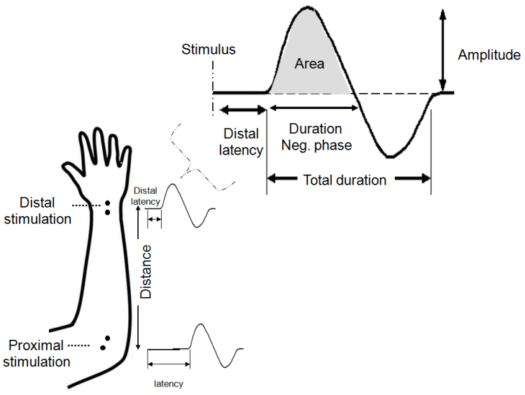 Recording Electrodes In Emg at Howard blog