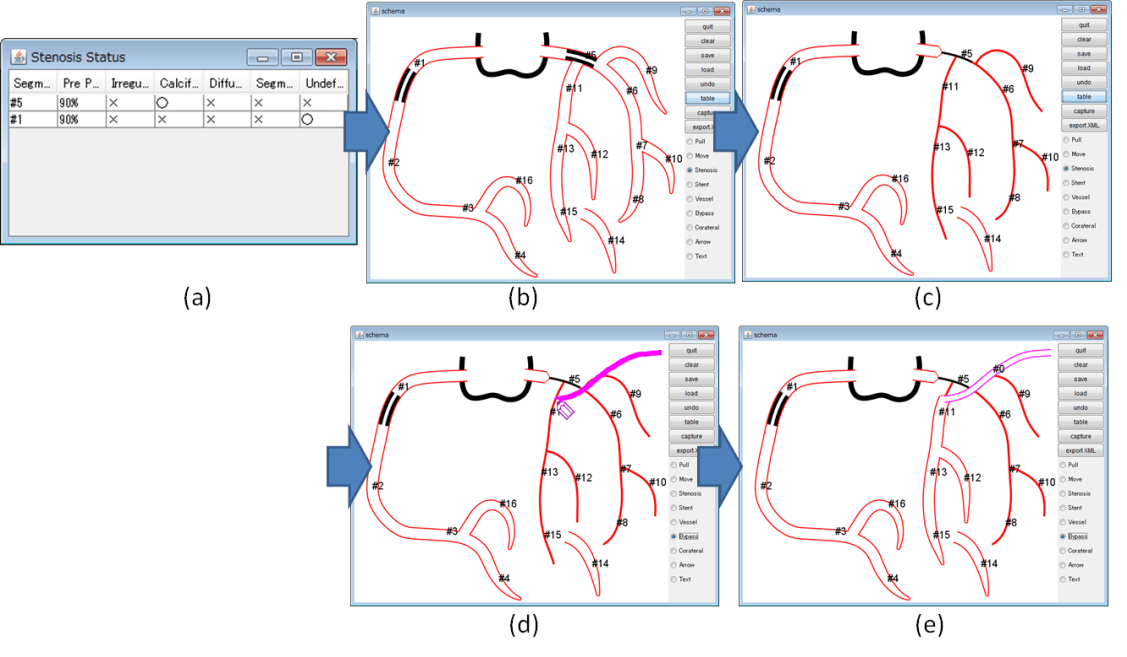 Generating Graphical Reports on Cardiac Catheterization IntechOpen