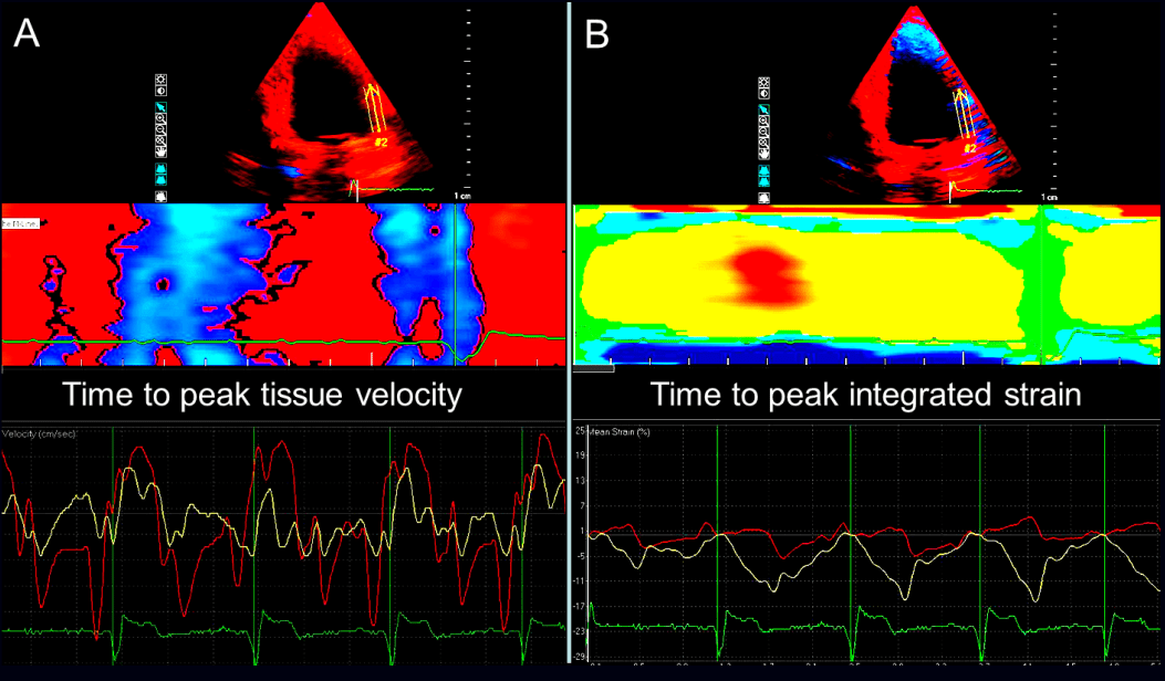Echocardiography Findings in Common Primary and Secondary