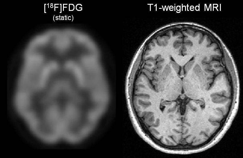 Basic PET Data Analysis Techniques IntechOpen