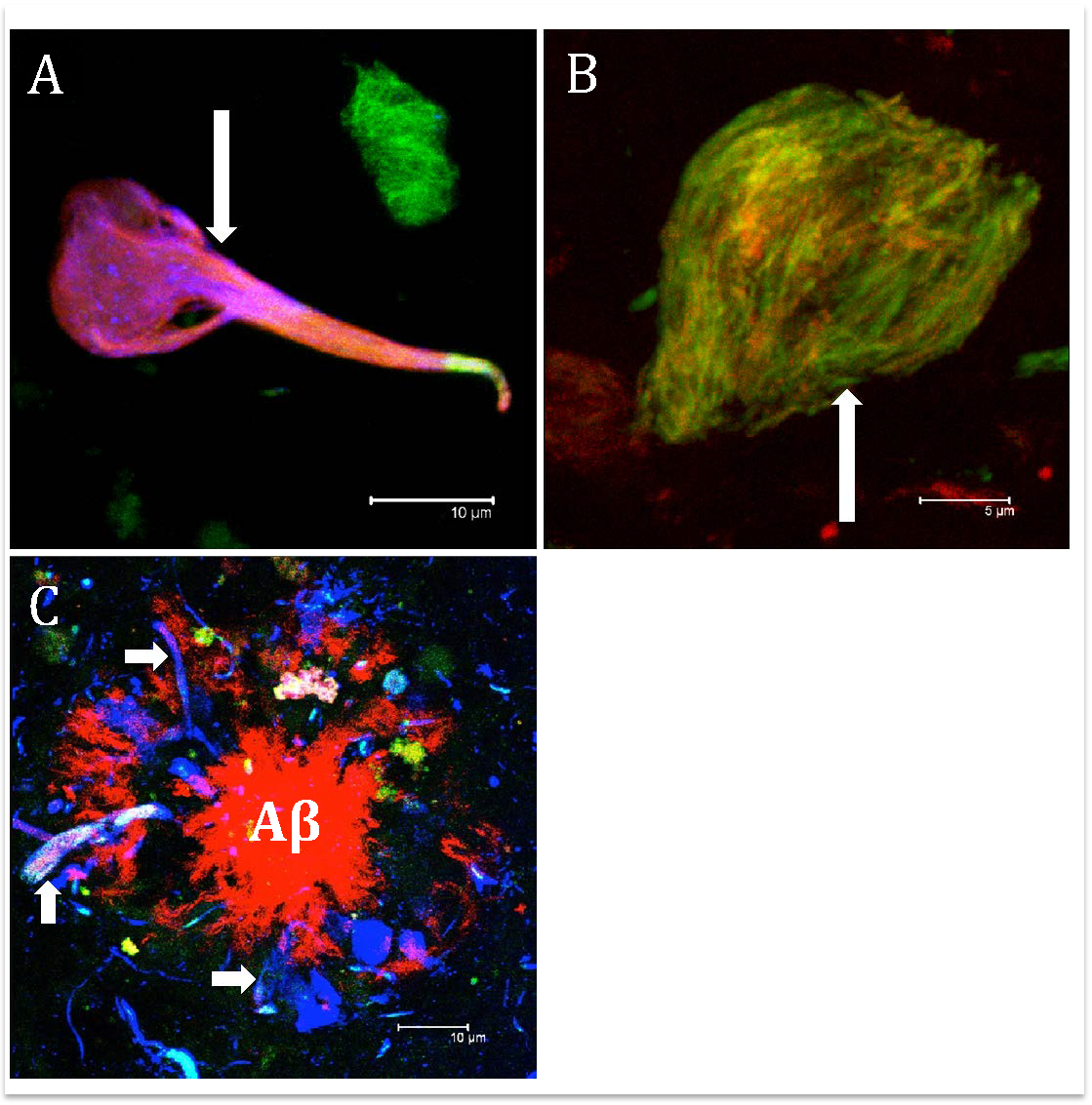 Neuroinflammation and Alteration of the BloodBrain