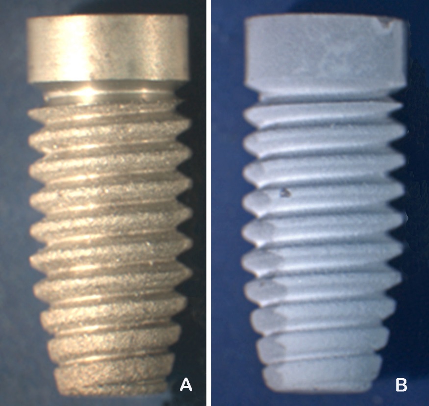 Drug Delivery Systems in Bone Regeneration and Implant Dentistry