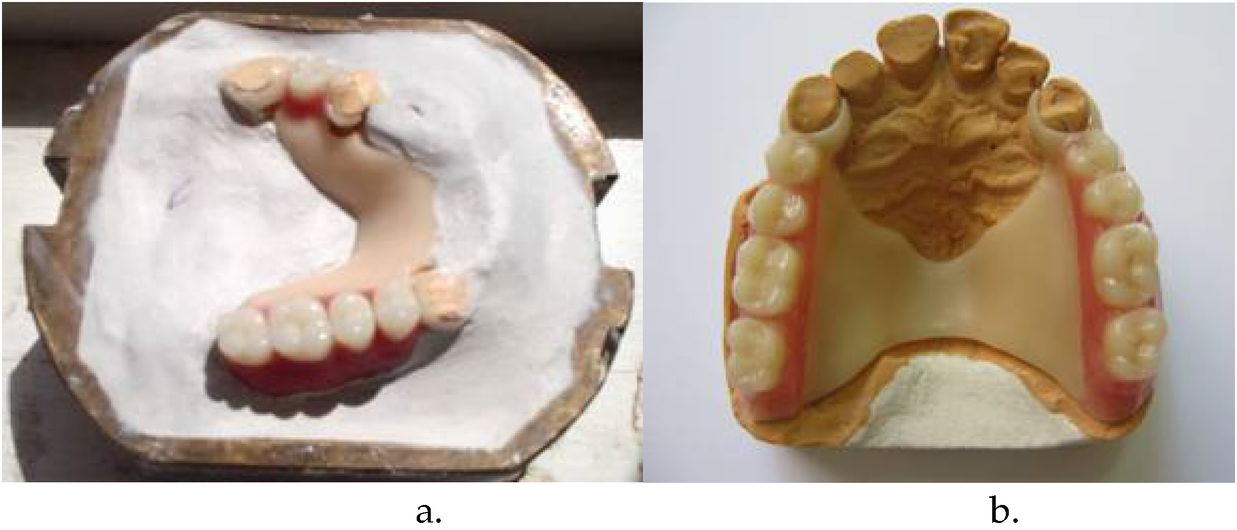Thermoplastic Resins used in Dentistry IntechOpen