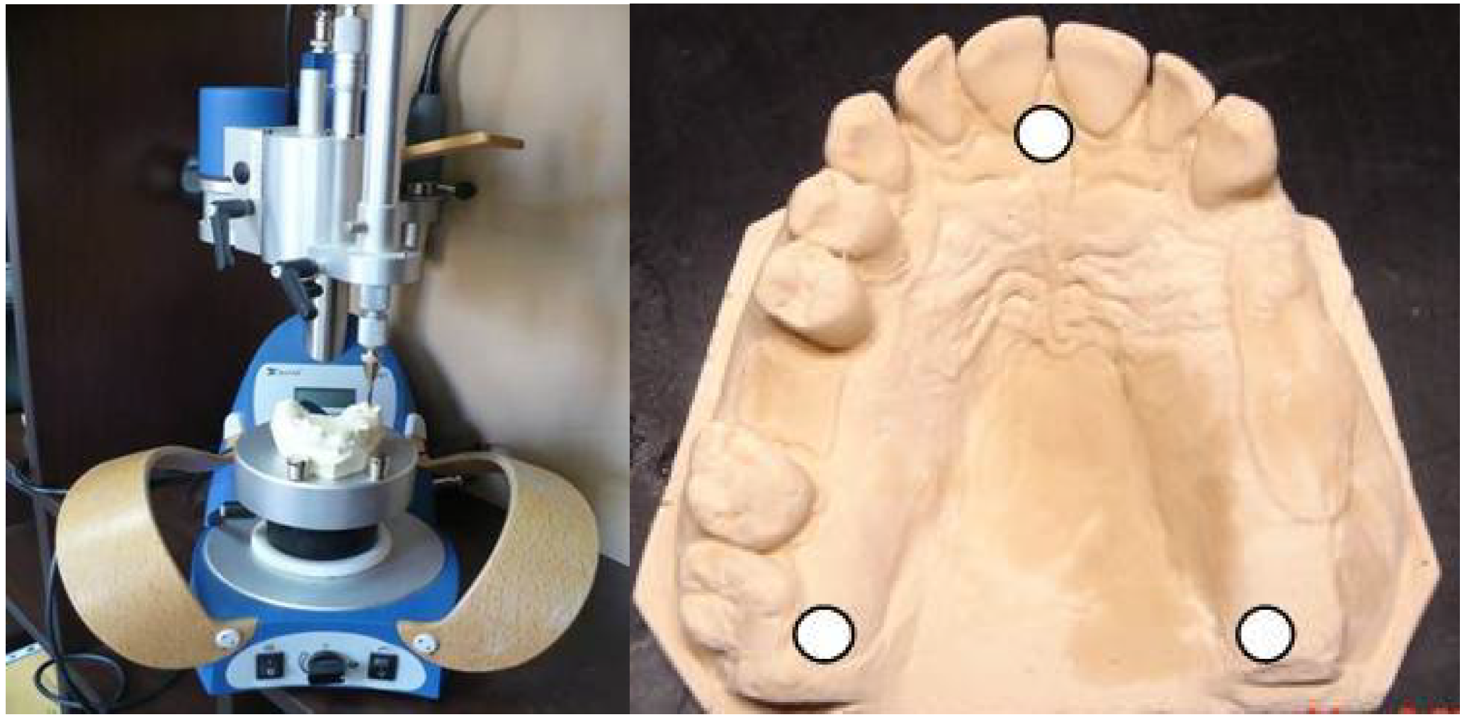 Thermoplastic Resins used in Dentistry IntechOpen