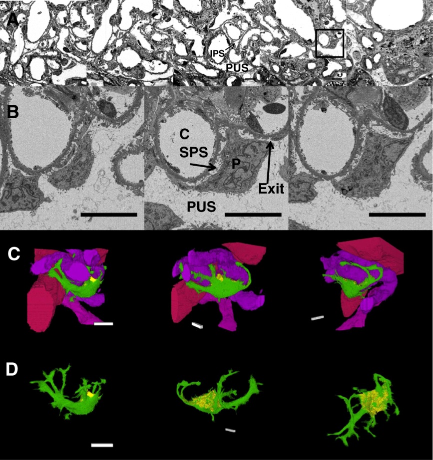 Evaluation of the Glomerular Filtration Barrier by Electron Microscopy