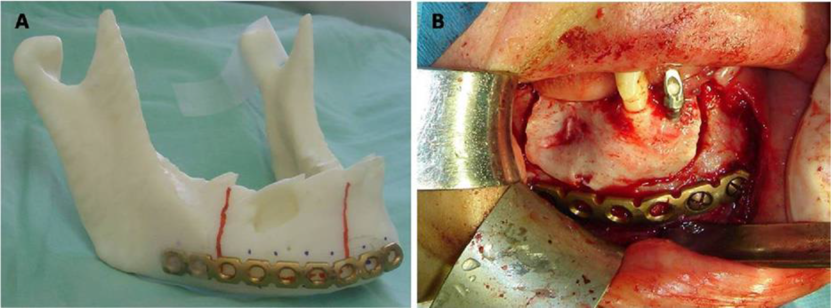 ThreeDimensional Printing A Novel Technology for Use in Oral and