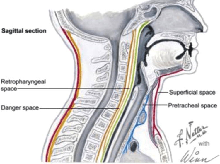 Antimicrobial Therapy and Surgical Management of Odontogenic Infections