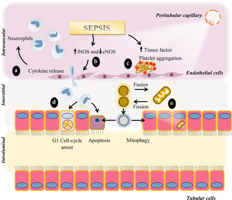 Sepsisassociated Acute Kidney Injury IntechOpen