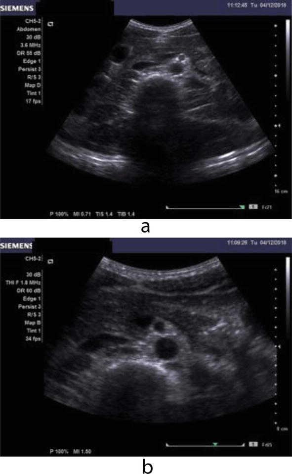 The Influence of Ultrasound Equipment Knobology in Abdominal Sonography