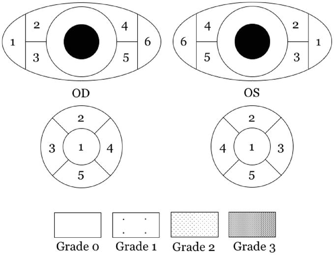 Examination for Dry Eyes IntechOpen