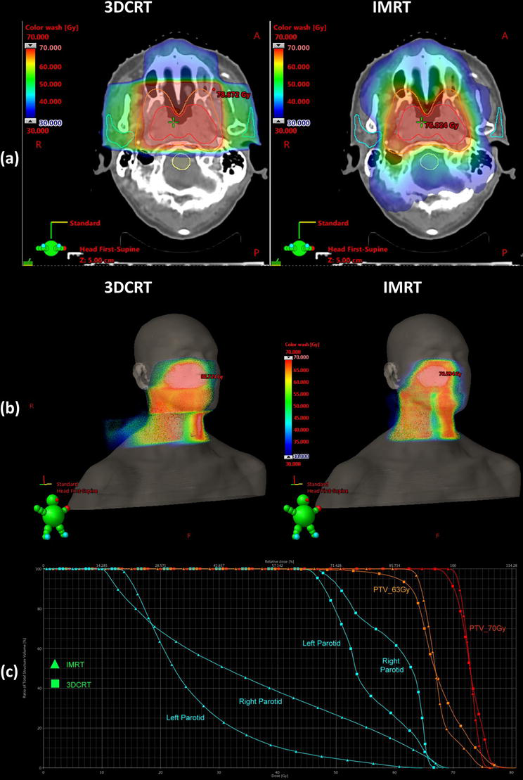 Treatment of Head and Neck Cancers Using Radiotherapy IntechOpen