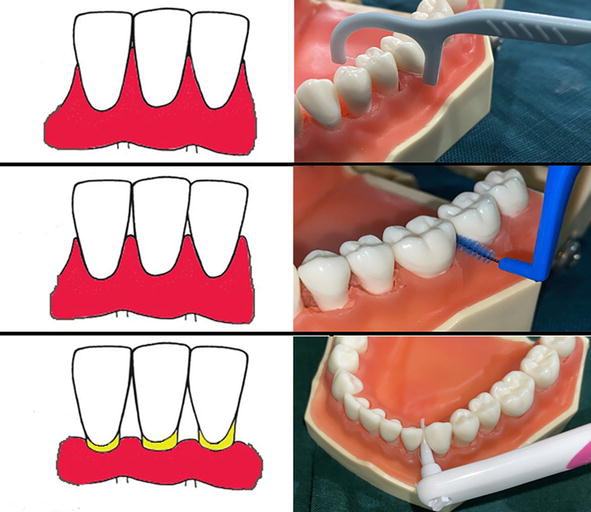 An Insight into Classification, Diagnosis and Comprehensive Management