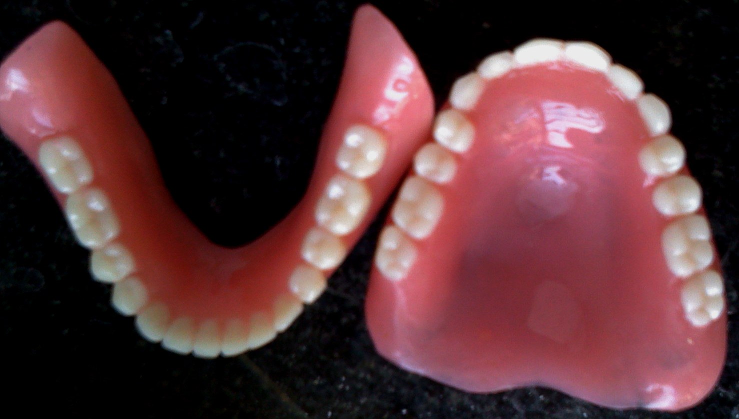 types of ultrathin dentures Intelligent Dental