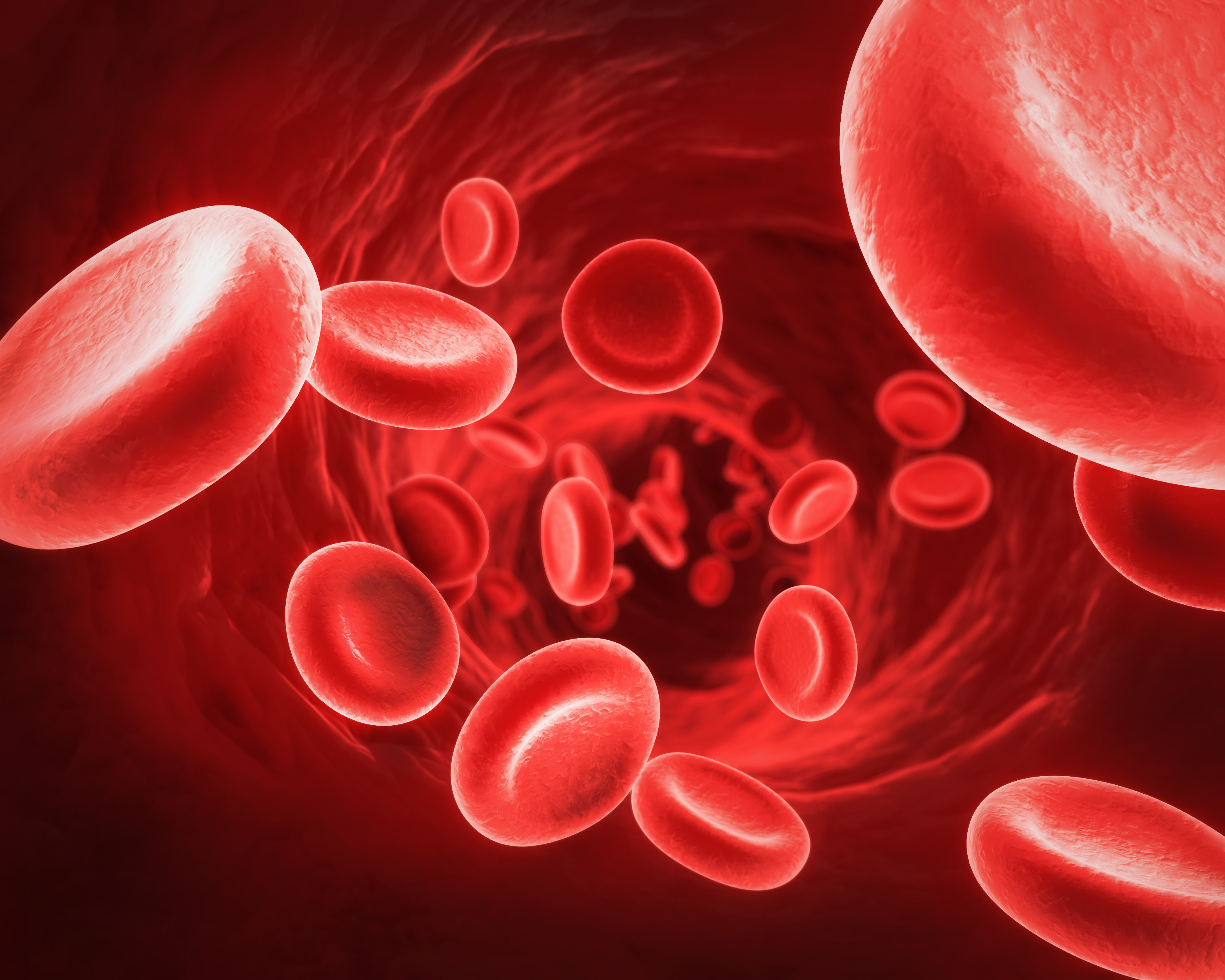 A Brief Review on Iron Deficiency Anemia Interactive