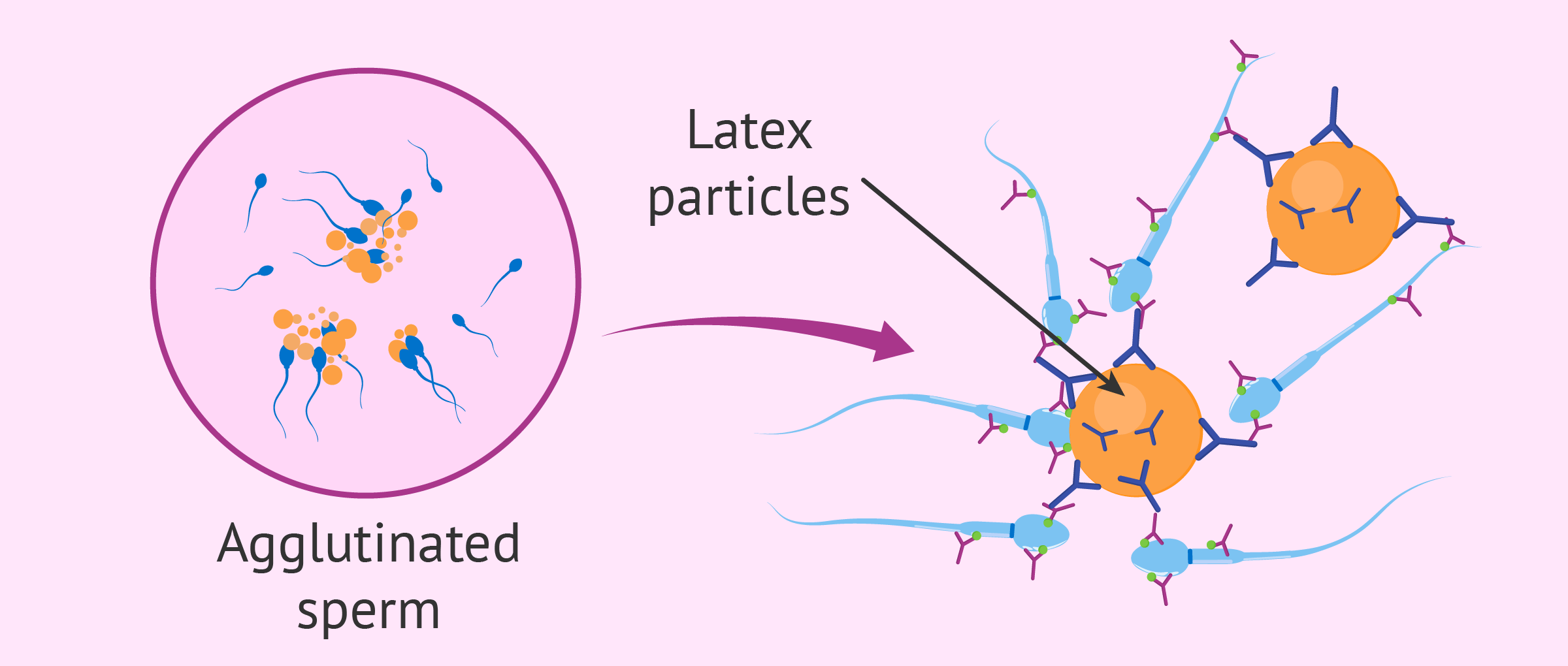 SpermMar test for detecting antisperm antibodies