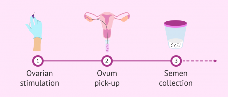 First IVF basic steps