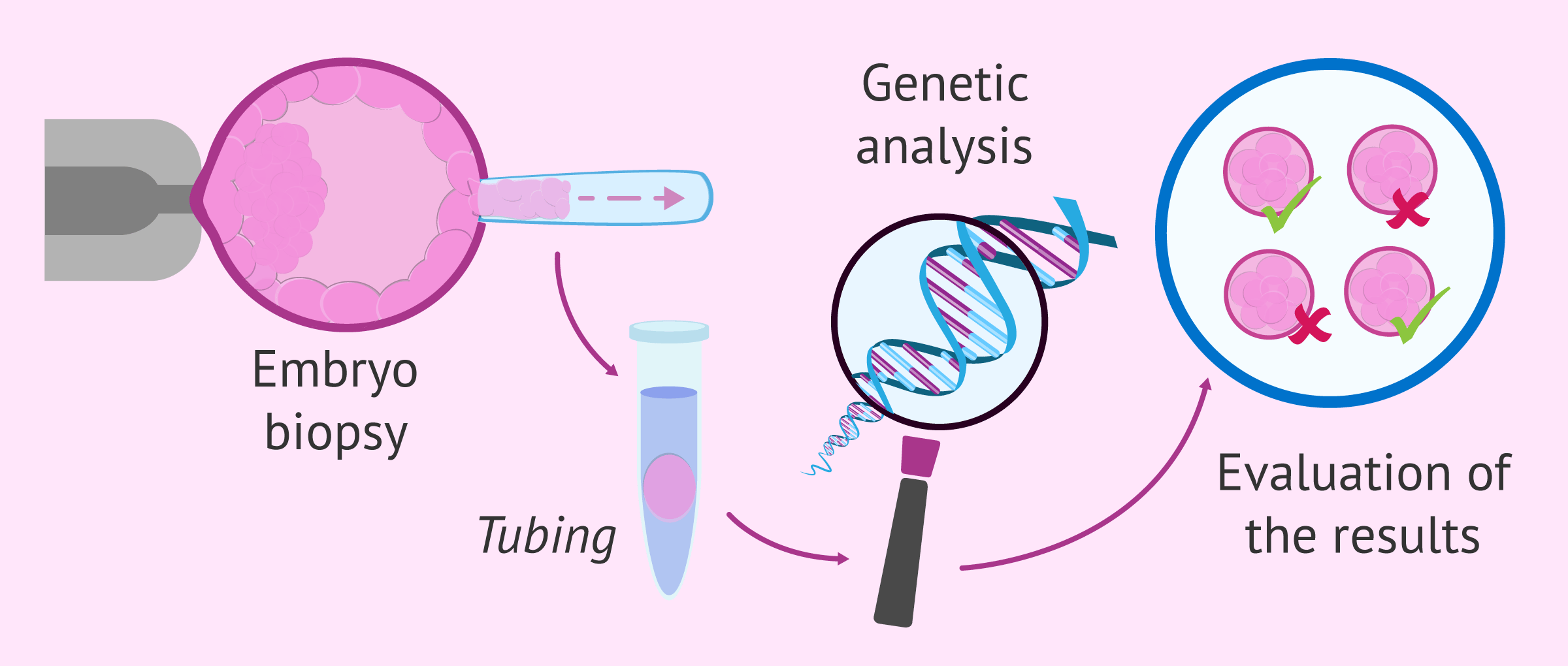 What is done in a PGD?